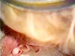 Thumb 6